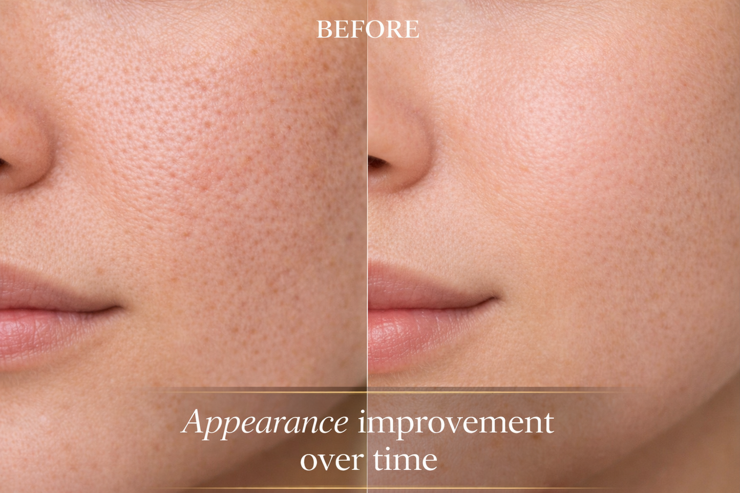 Derma Stamp for Pores & Texture | Smoother-Looking Skin at Home