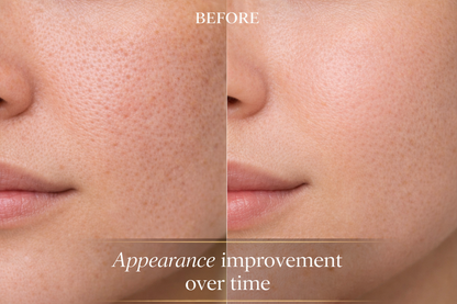 Derma Stamp for Pores & Texture | Smoother-Looking Skin at Home